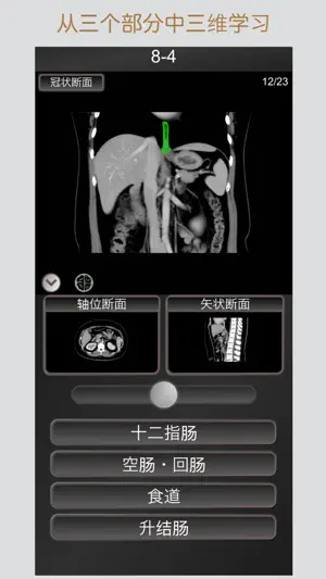 CT 护照测验 腹部 / 剖面解剖/ MRI