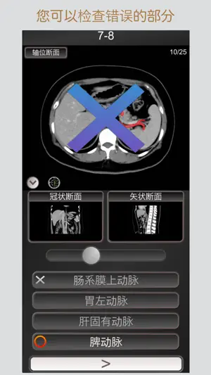 CT 护照测验 腹部 / 剖面解剖/ MRI